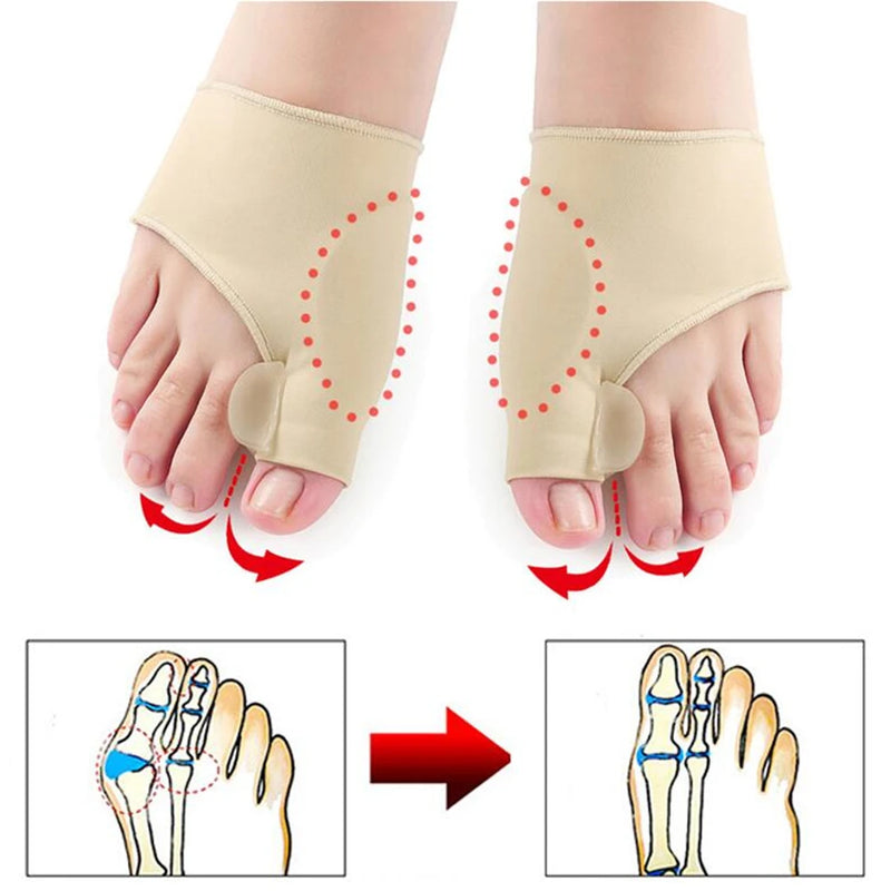 OrtoMeia Flex – Meia Corretiva para Joanete