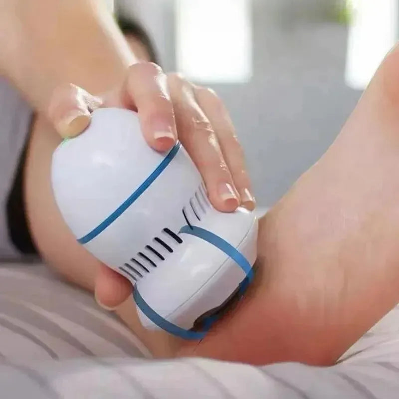 FootClean Pro – Removedor de Calos com Aspiração a Vácuo